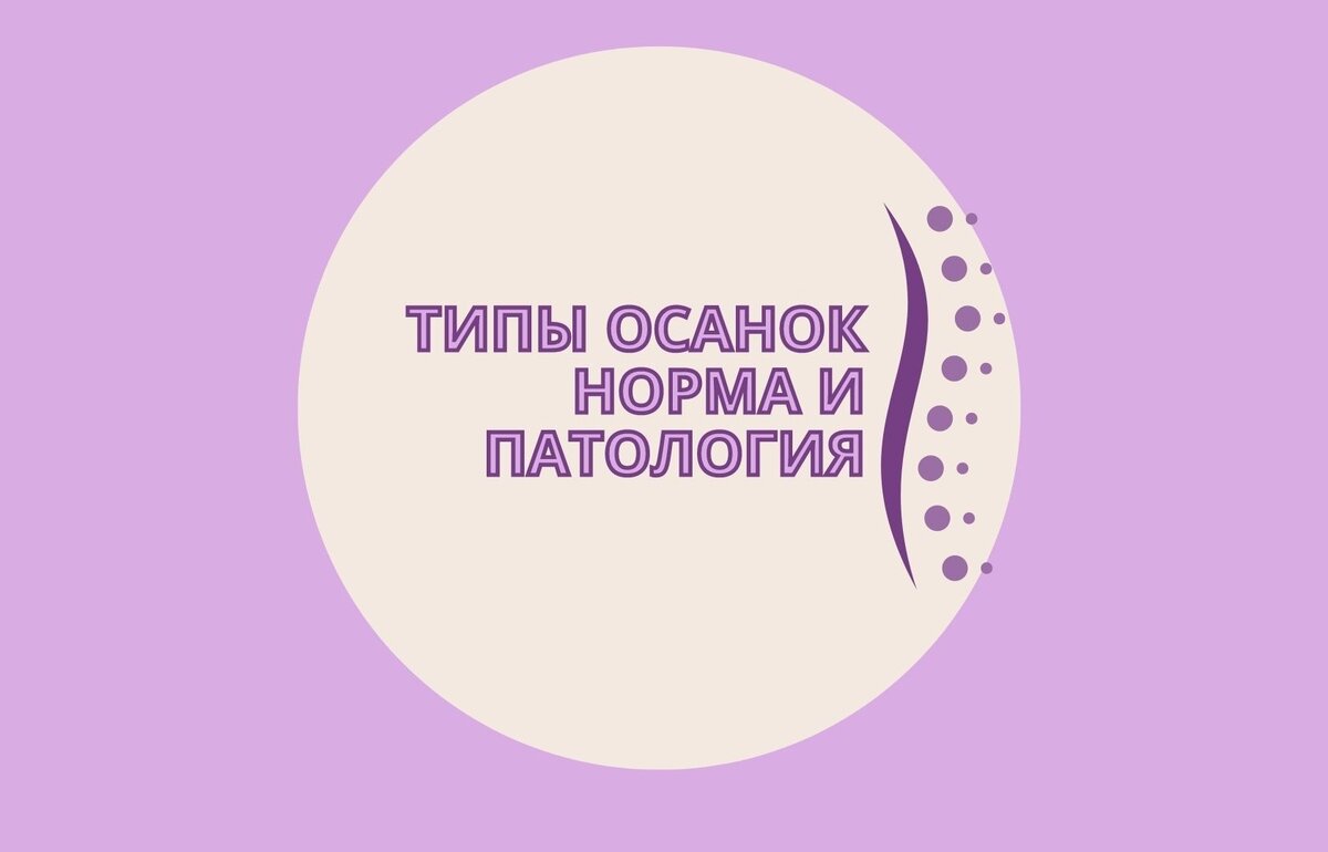 Типы осанок