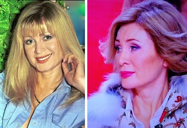 Певица Вика Цыганова: Как выглядела до того как стала увлекаться пластикой - VEA