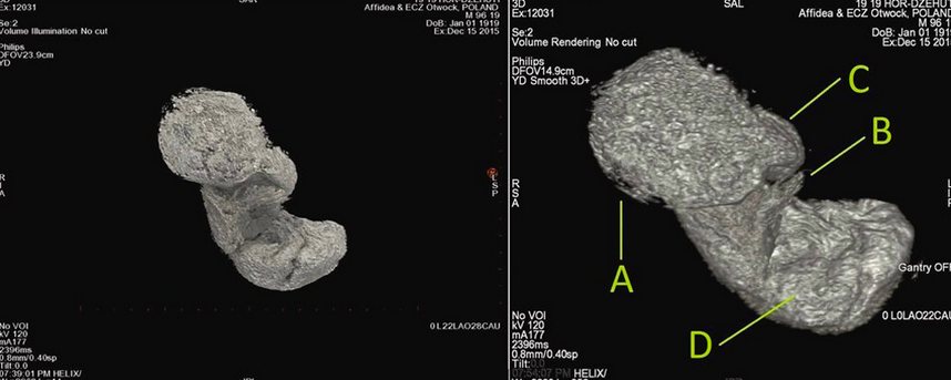 Исследователи объяснили, как мумифицировался плод внутри египтянки, жившей около 2000 лет назад. Фото: Warsaw Mummy Project