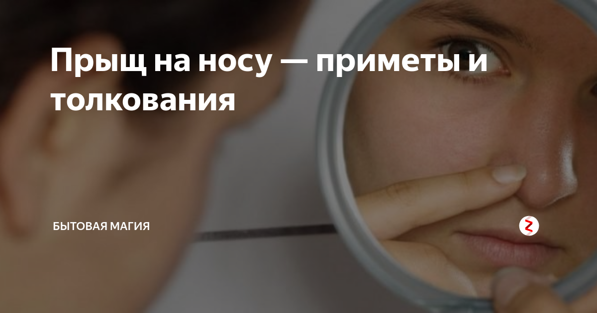 Plastic surgery landing. обозначение родинок на лице. прыщ на носу слева примета. родинка на лице на скуле. родинки на лице под левым глазом.