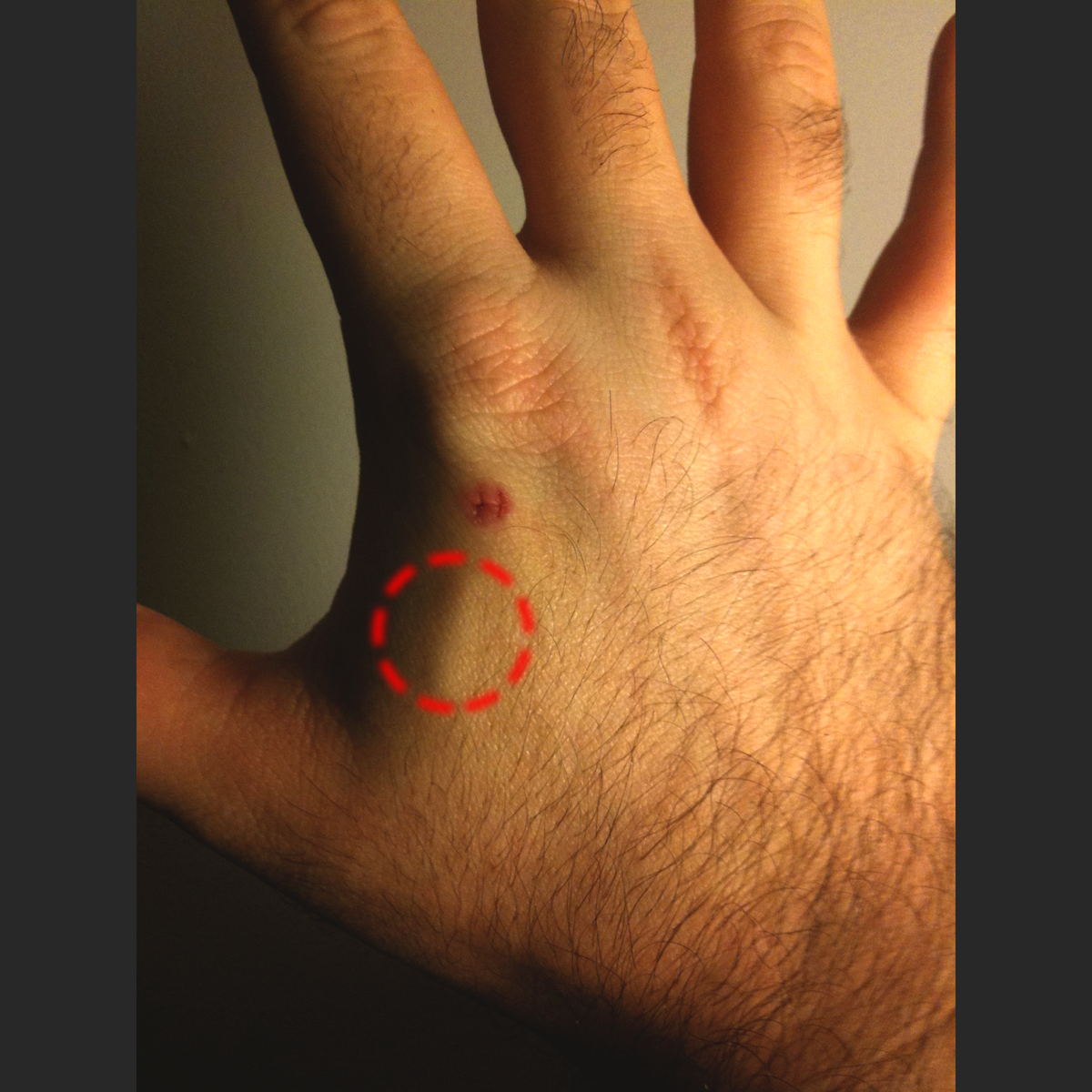 Источник: https://ru.wikipedia.org/wiki/%D0%A4%D0%B0%D0%B9%D0%BB:RFID_hand.jpg