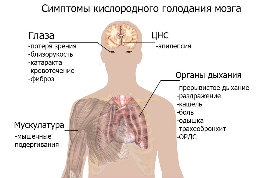 Признаки кислорода. Кислородное голодание симптомы. Симптомы кислородного голодания головного мозга. Кислородное голодание мозга симптомы у взрослых.