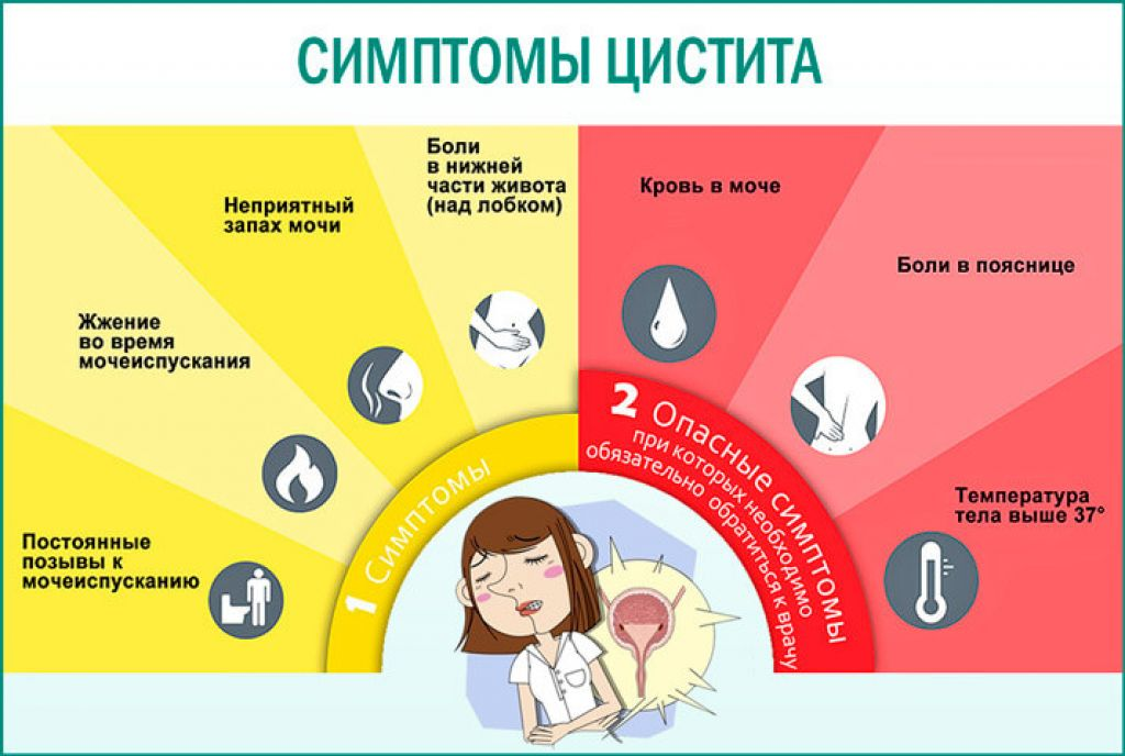 Как понять что цистит. Цистит у женщин симптомы. Цистит симптомы. Признаки цистита. Симптомы при цистите.