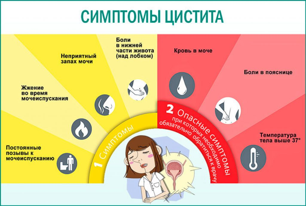 Как проявляется цистит. Цистит у женщин симптомы. Цистит симптомы. Признаки цистита. Симптомы при цистите.