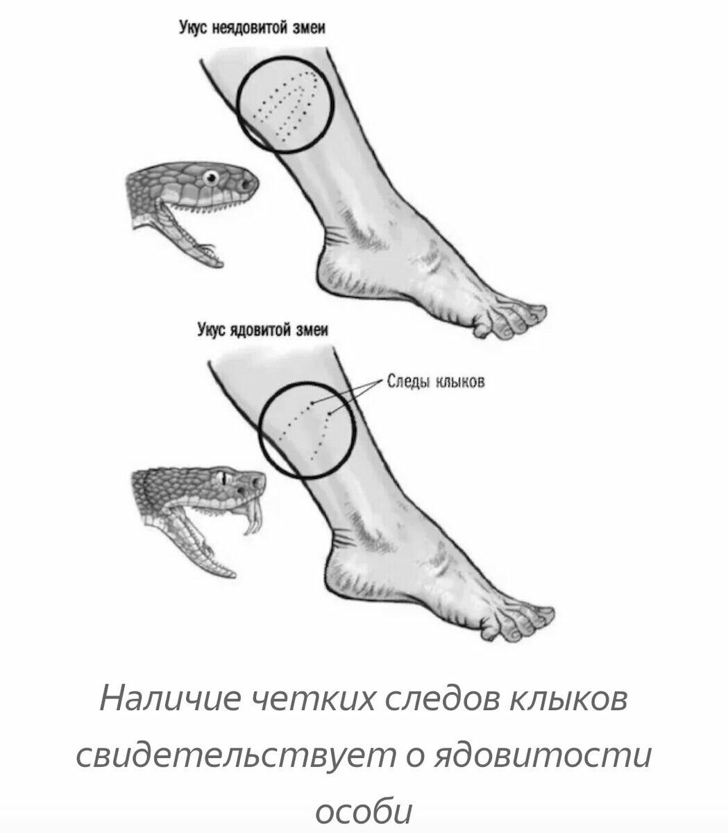 Укус змеи виды. Укус ядовитой и неядовитой змеи. Как выглядят укусы змей. Как выглядит укус ядовитой змеи.