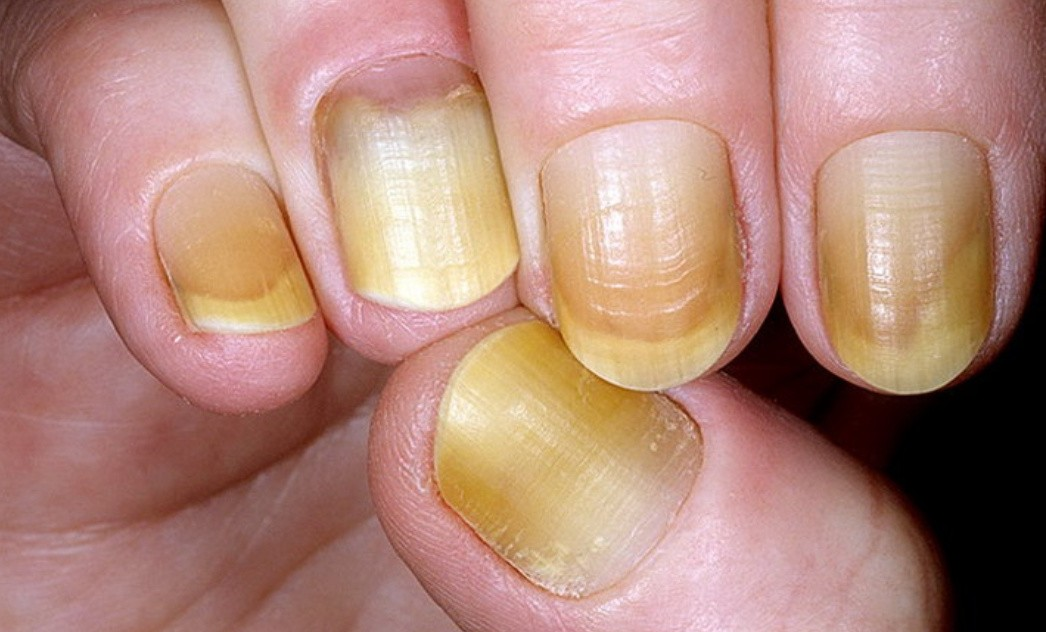 фото с сайта yournails.ru