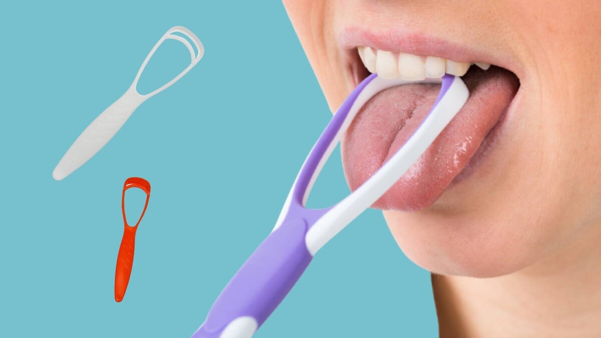 Рвотный рефлекс при лечении зубов: что делать?