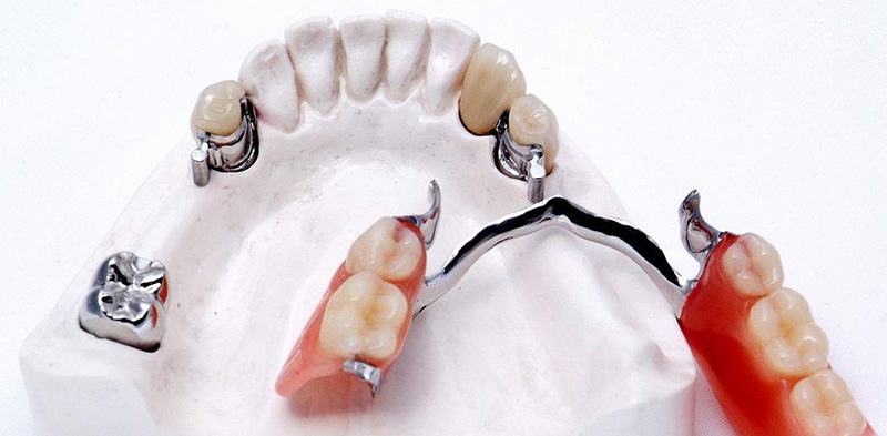 Источник: Новадент