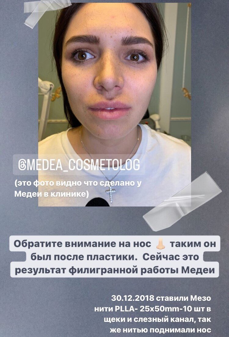 Беременная жена Константина Ивлева объяснила, зачем ей необходимо ездить на капе