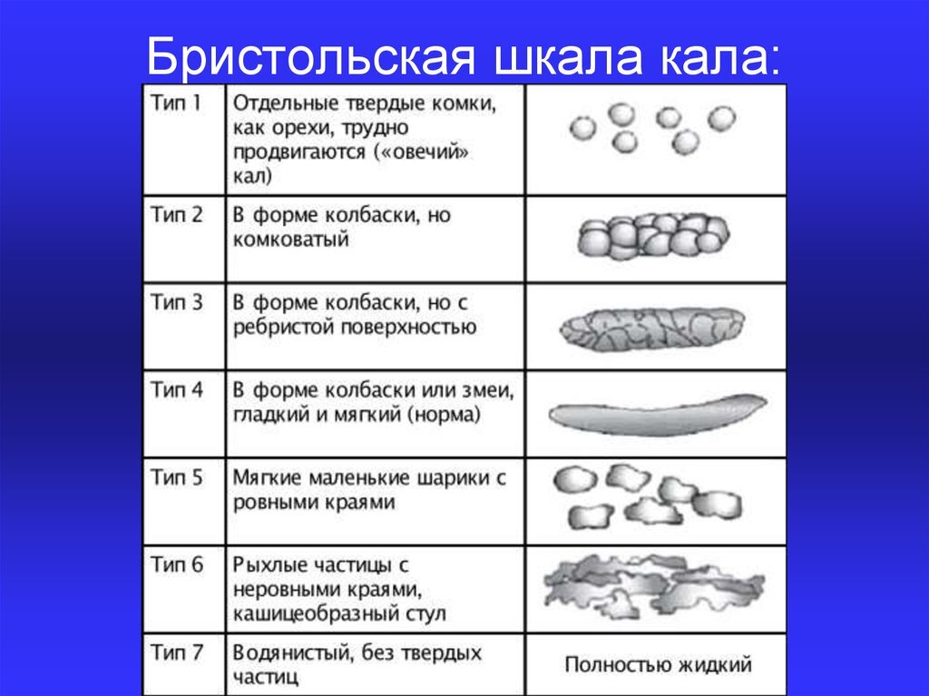 Сила м о кала. Бристольская шкала кала 6 Тип. Бристольская классификация формы кала. Бристольская шкала формы кала 4. Таблица кала по Бристольской шкале.