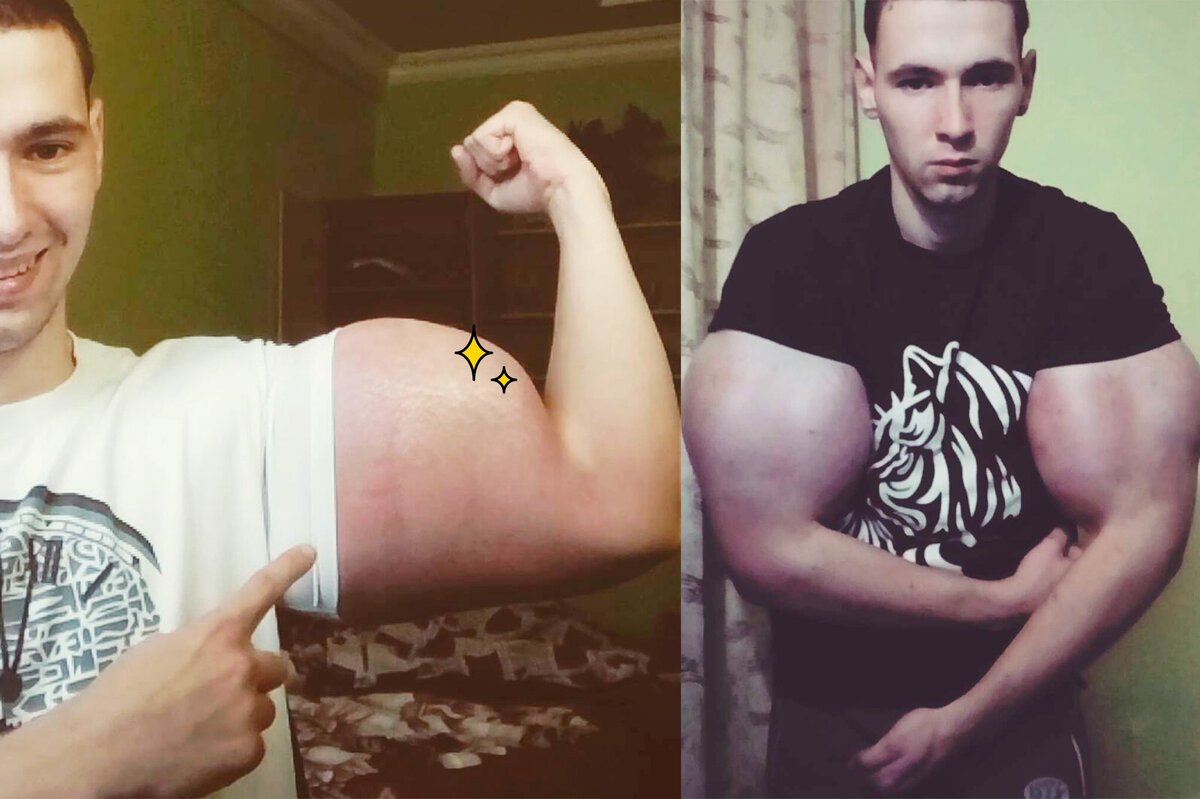     Как выглядит сегодня легендарный фрик Кирилл «руки-базуки» Терешин — и что еще он себе увеличил