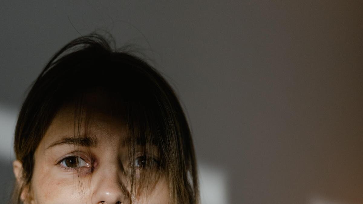    Женщина с синяками под глазами:pexels.com