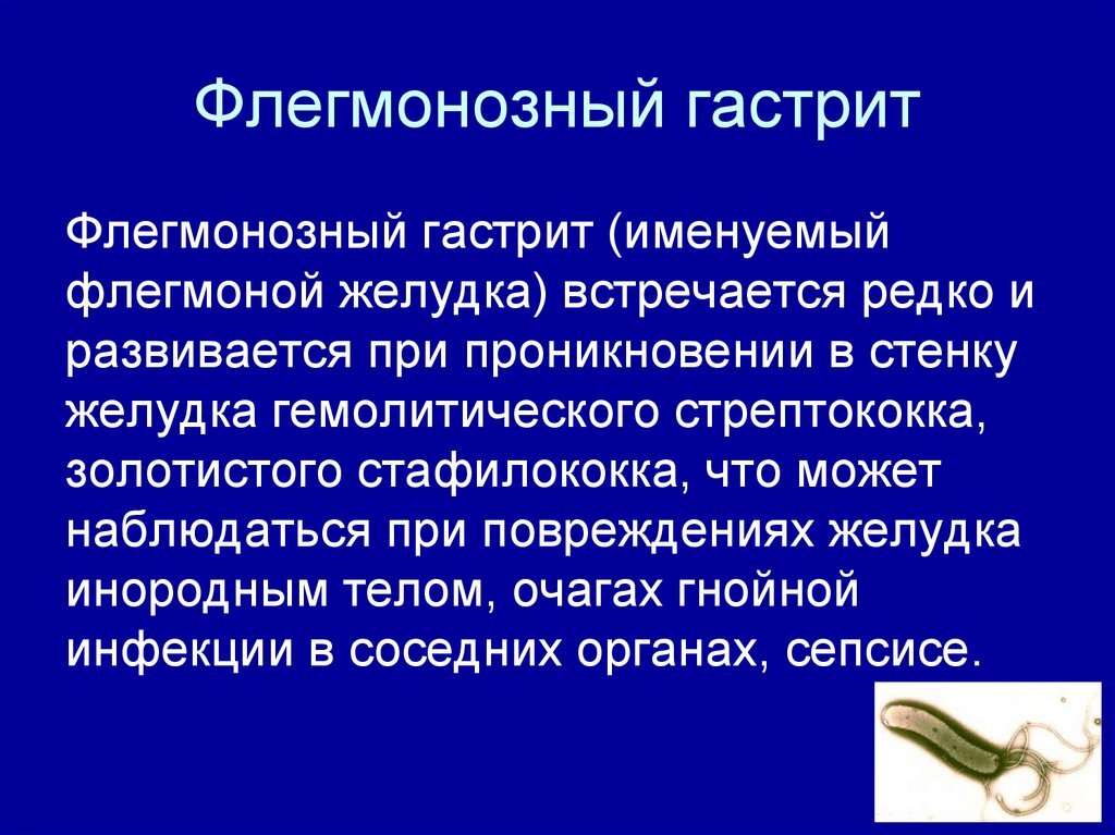 Осложнения дивертикулярной болезни