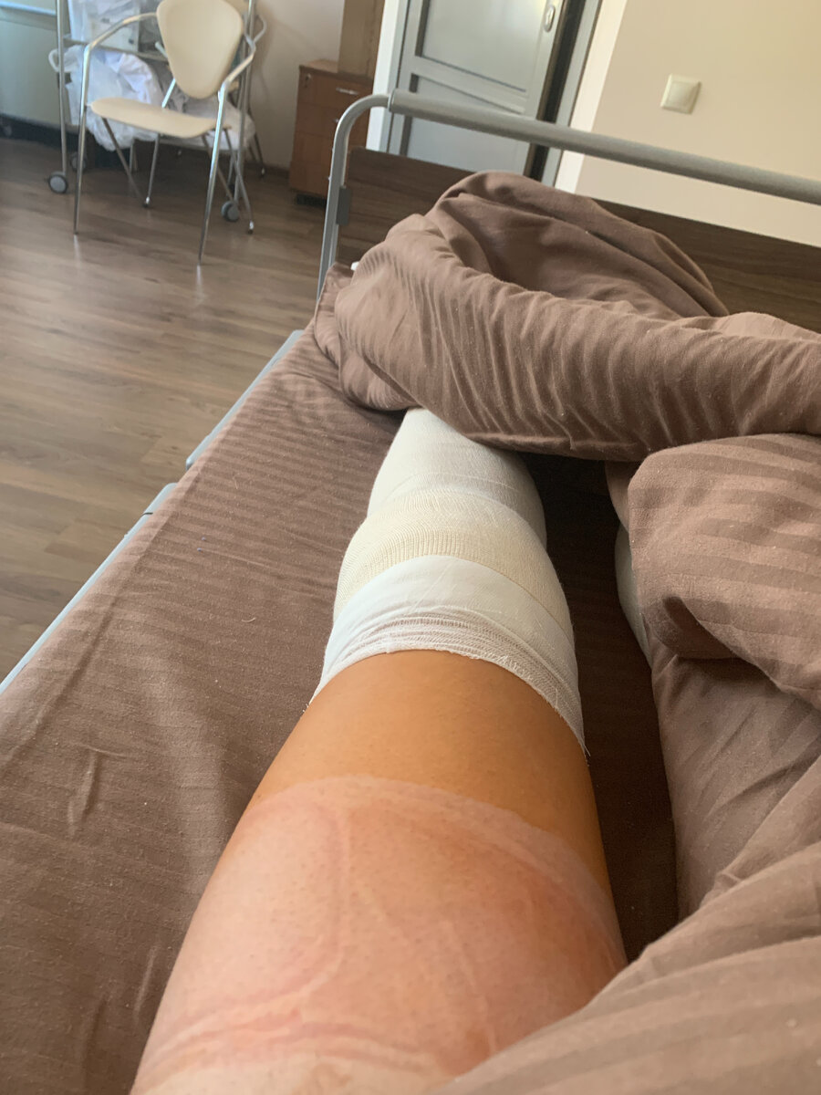 Через час после операции