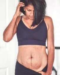 Живот после родов