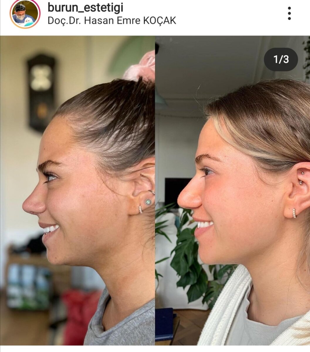 Фото из İnstagram