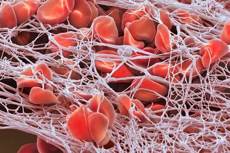     Cамое дорогое лекарство в мире: $3,5 миллиона стоит разовое лечение от гемофилии