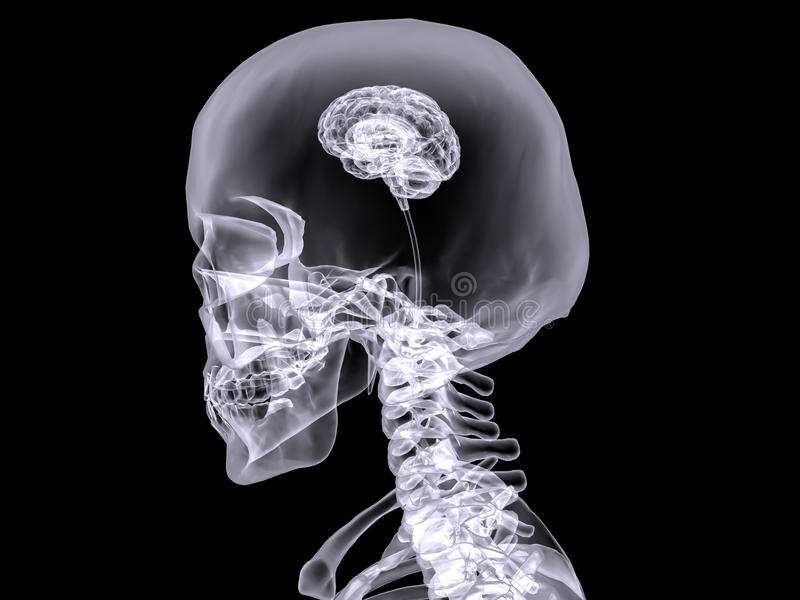 Рентген мозга. Снимок головы с маленьким мозгом. Рентгеновский снимок мозга. Мозги без черепа