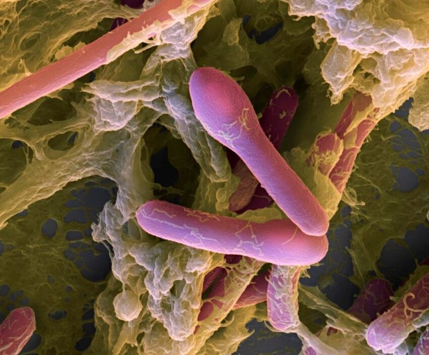 Именно так выглядят бактерии Cl. Botulinum. Внешне они напоминают барабанные палочки, или же теннисные ракетки, что является морфологической формой фазы активной жизнедеятельности