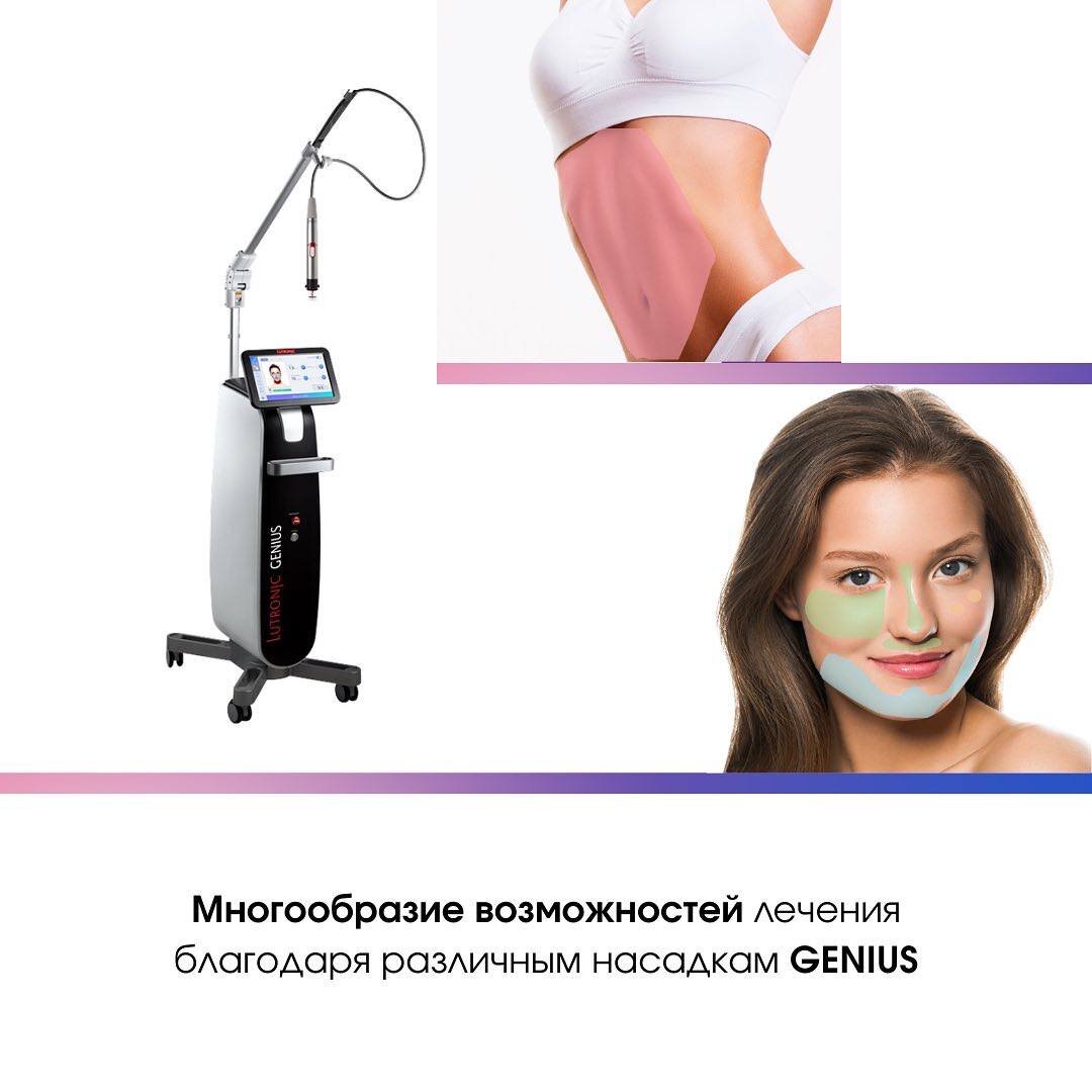 https://bellasystech.ru/catalog/equipment/genius/