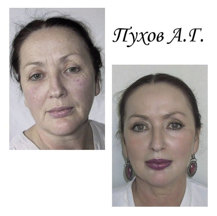 instagram: @doctor_puhov