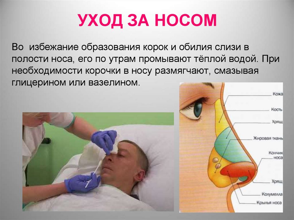 Уход включает в себя