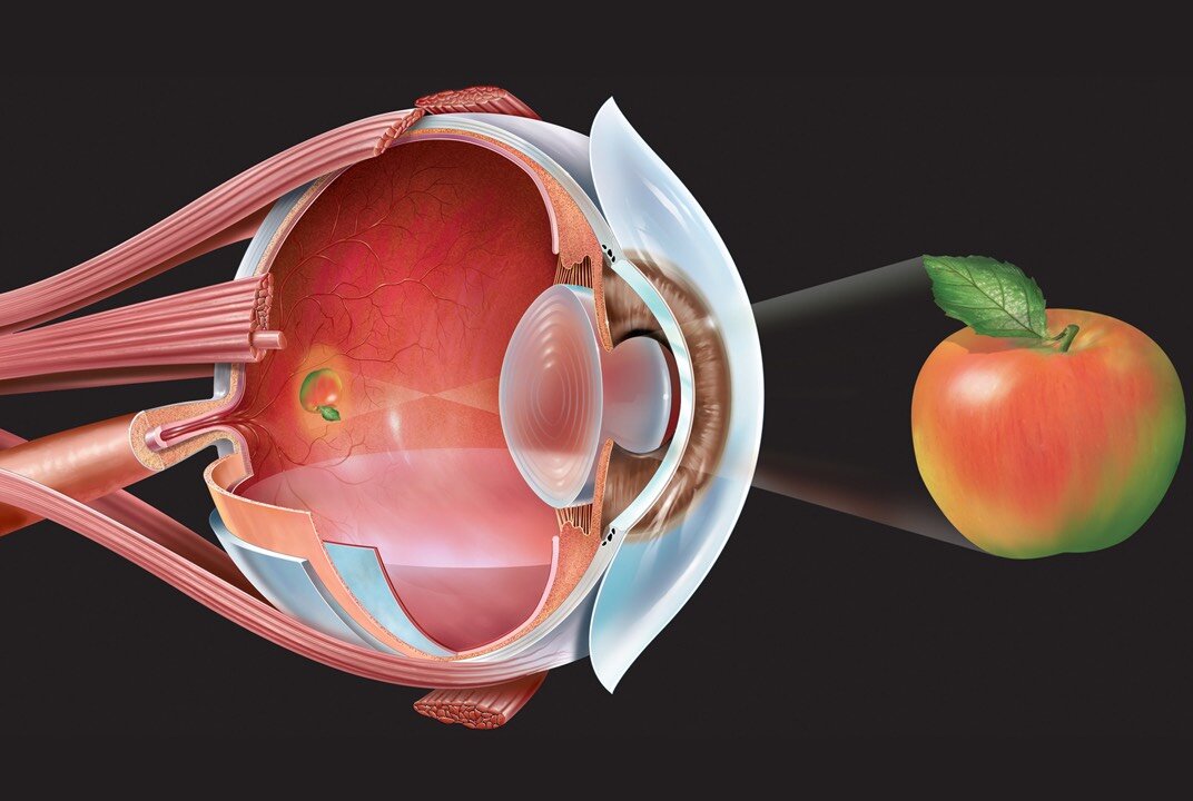 Как создается четкое изображение на сетчатке когда