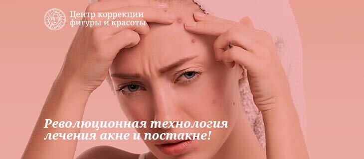 Революционная технология elos предлагает долгосрочные решения для лечения акне и рубцов постакне