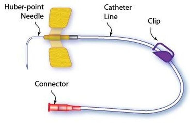 Фото с сайта https://mavink.com/explore/Huber-Procedure