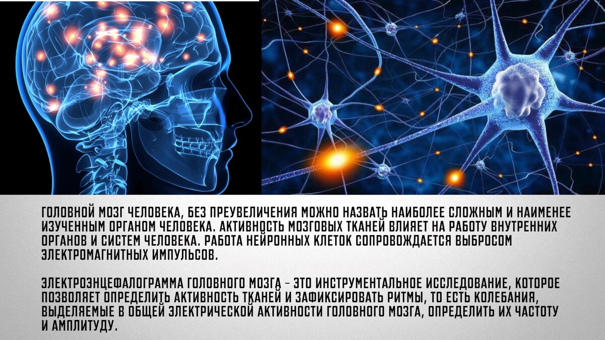 Энергия циркулирующая по нашей нервной системе управляется нашим мозгом. Её характеристики можно определить, исследовать, измерить, и подтвердить документально при помощи проведения ЭЭГ.  Однако и по сей день, у многих людей определение "энергетика" - вызывает лишь скептическую улыбку, несмотря на очевидную доказательную базу. 