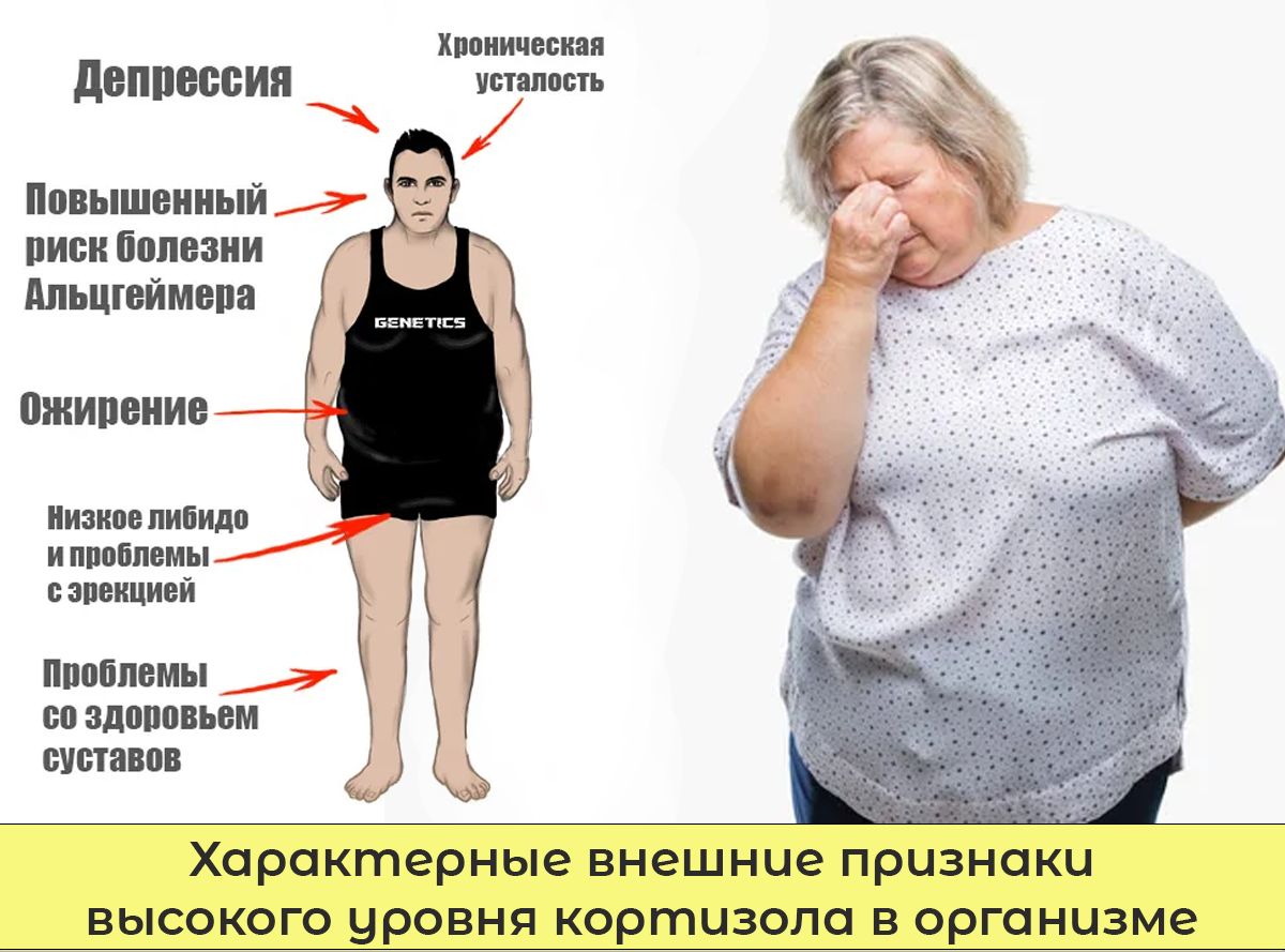 Характерные внешние признаки высокого уровня кортизола