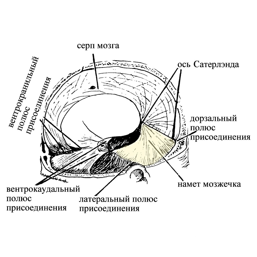 Твердая мозговая оболочка намет мозжечка. Большой серповидный отросток твердой мозговой оболочки. Серп большого мозга и намет мозжечка. Отростки твердой мозговой оболочки головного мозга.