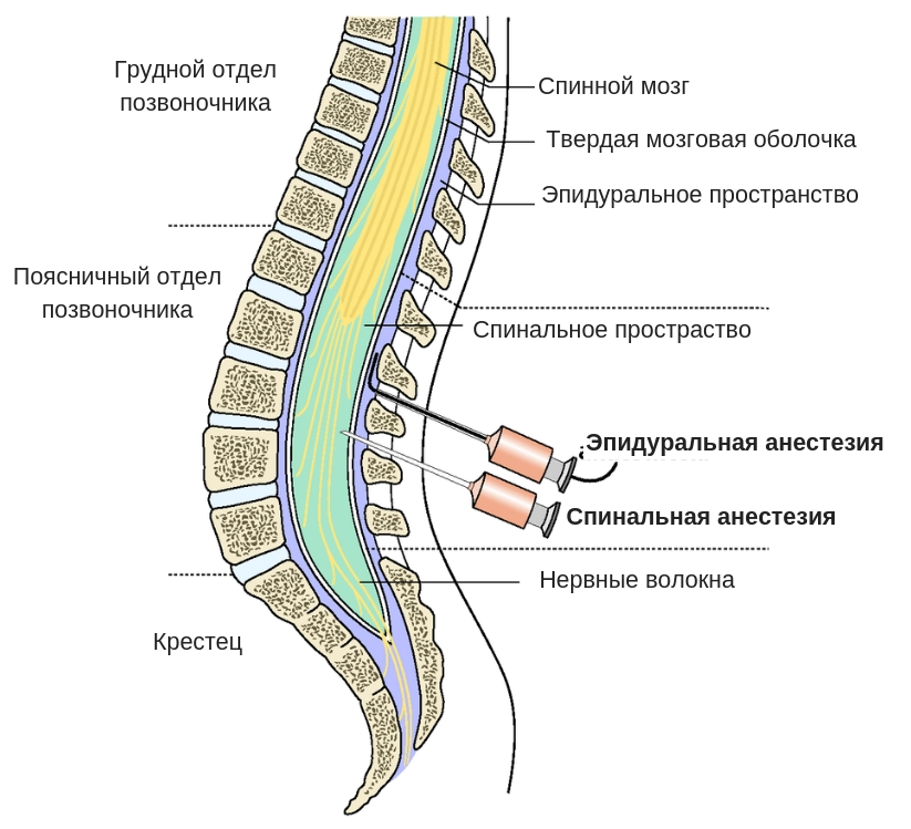 Эпидуральная анестезия строение спинного мозга. Люмбальная эпидуральная анестезия. Спинномозговая анестезия и эпидуральная анестезия отличия. Спинальная анестезия и эпидуральная анатомия.