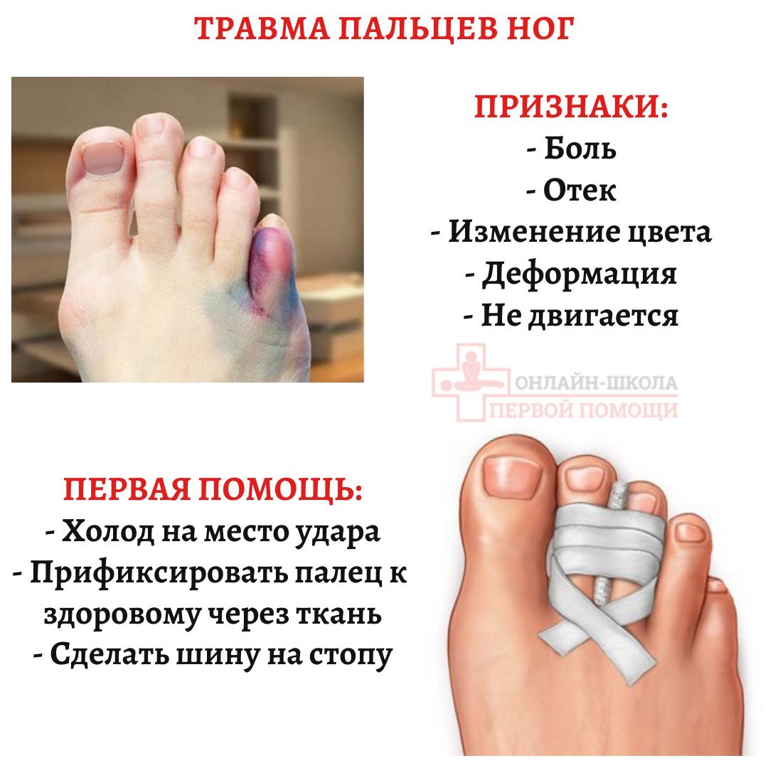 Чем можно снять ушиб - 11/48
