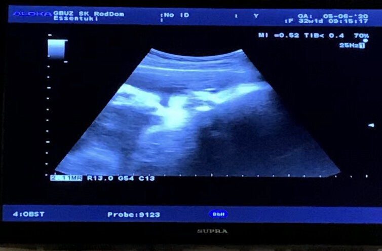 Да да, это я. Такой маленький...