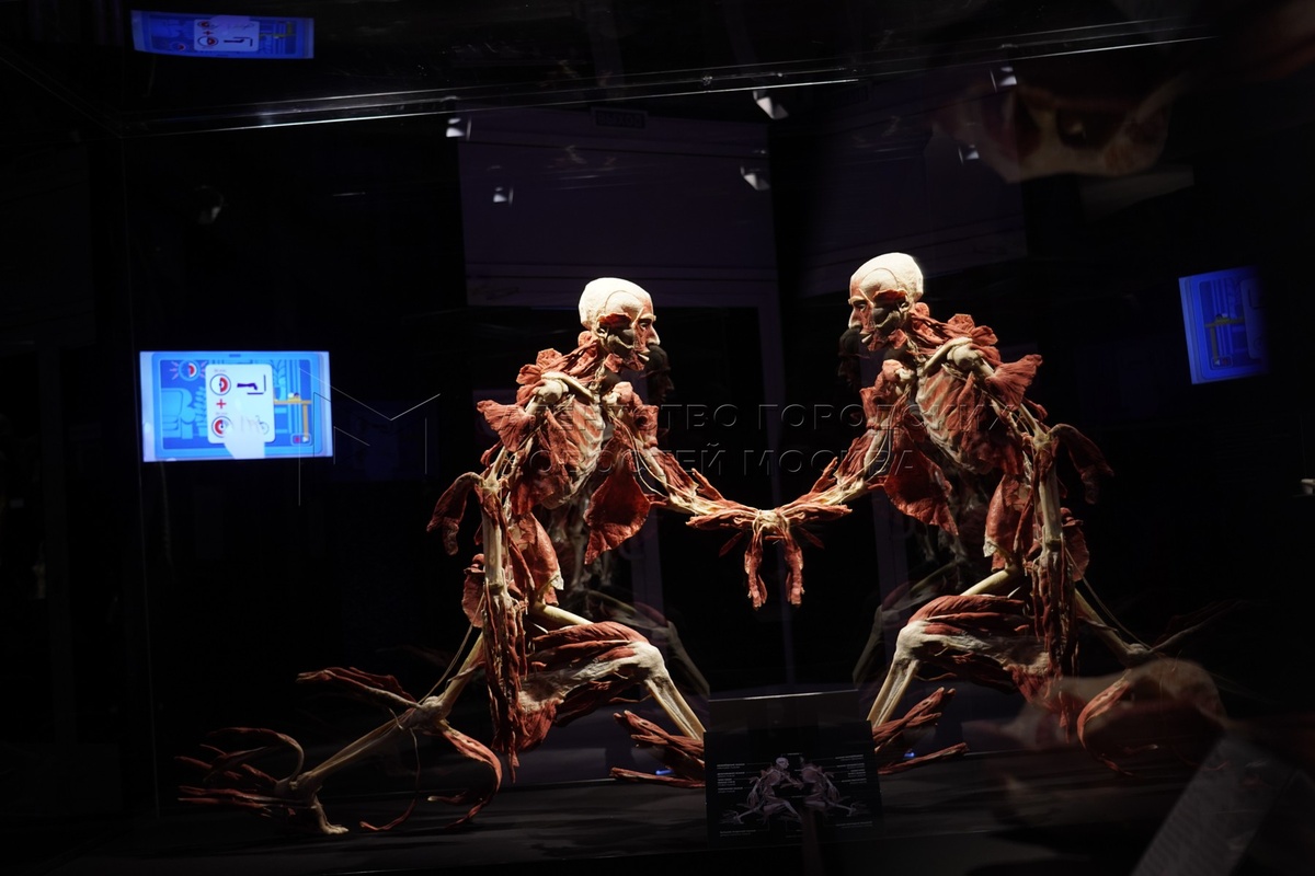 Экспонаты выставки Body Worlds. Фото из публичного доступа интернета