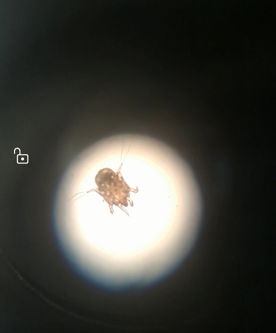 Это фото с микроскопа , самка клеща, фото автора.