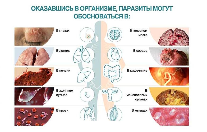 Паразиты в организме человека фото и описание