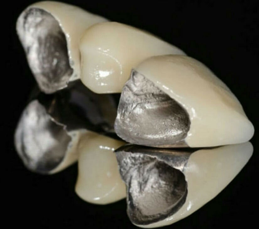 У меня такая же картина, один из пеньков был настолько мал, что коронку отдельно не насадить, и этот зуб просто сдвоен с реальной коронкой.