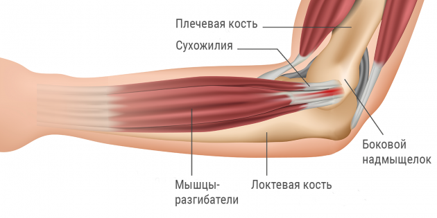 Боль в локтевом суставе - причины и лечение