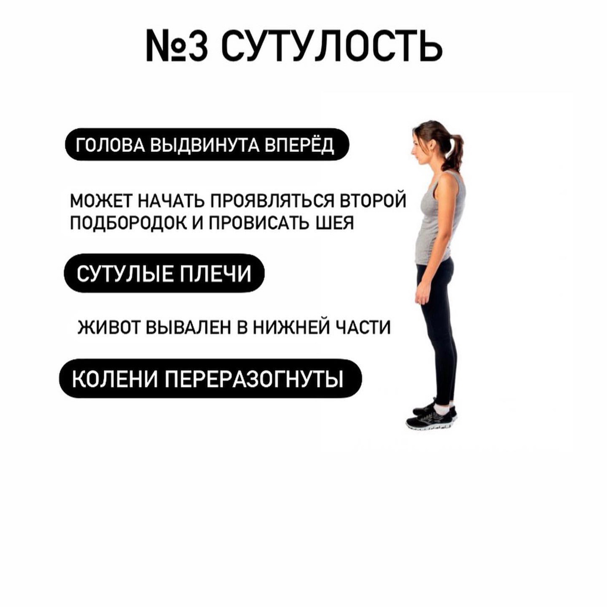 Шея выдвинута вперед. Голова выдвинута вперед. Сутулая. Сутулая шея как исправить
