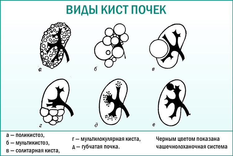 Гипертония у детей и подростков