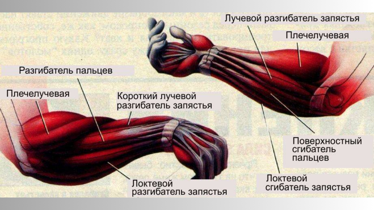 Миозит мышц предплечья