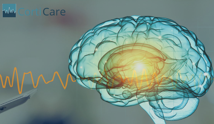 CortiCare - new approach to EEG recording