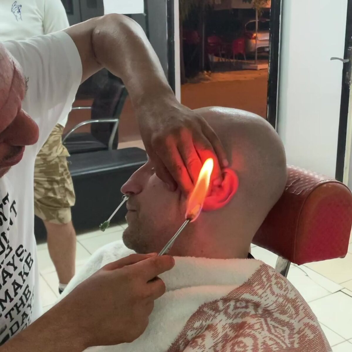 Депиляция ушей огнем