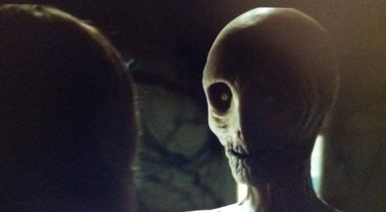 Уже тогда,  задолго до болезни, при просмотре фильма, мне пришла в голову мысль о том, насколько прочные и точные ассоциации вызывает короткое зловещее буквосочетание "рак" - именно такие, как показаны в "Сомнии": непременно усохшее, бессильное желтушное тело, утратившее не то что гендерные признаки -  человеческие черты. Фото с просторов Яндекса.