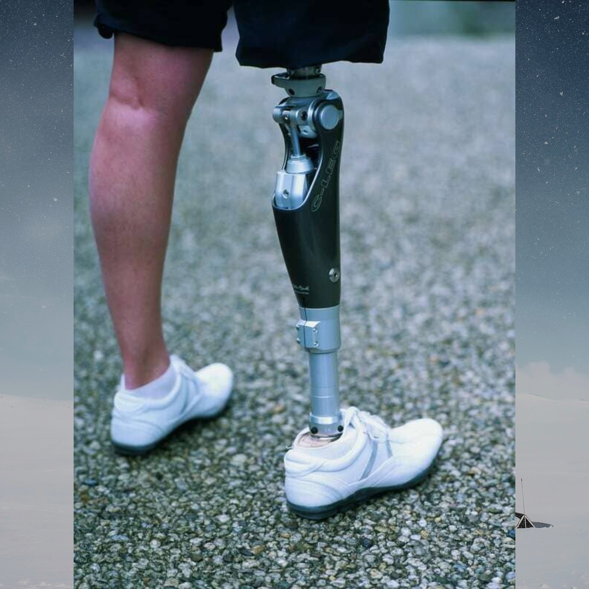 Otto bock протезы для ног. Протез бедра модульный пн6-71. Металлический протез ноги. Протез ноги. Нужны протезы ног.