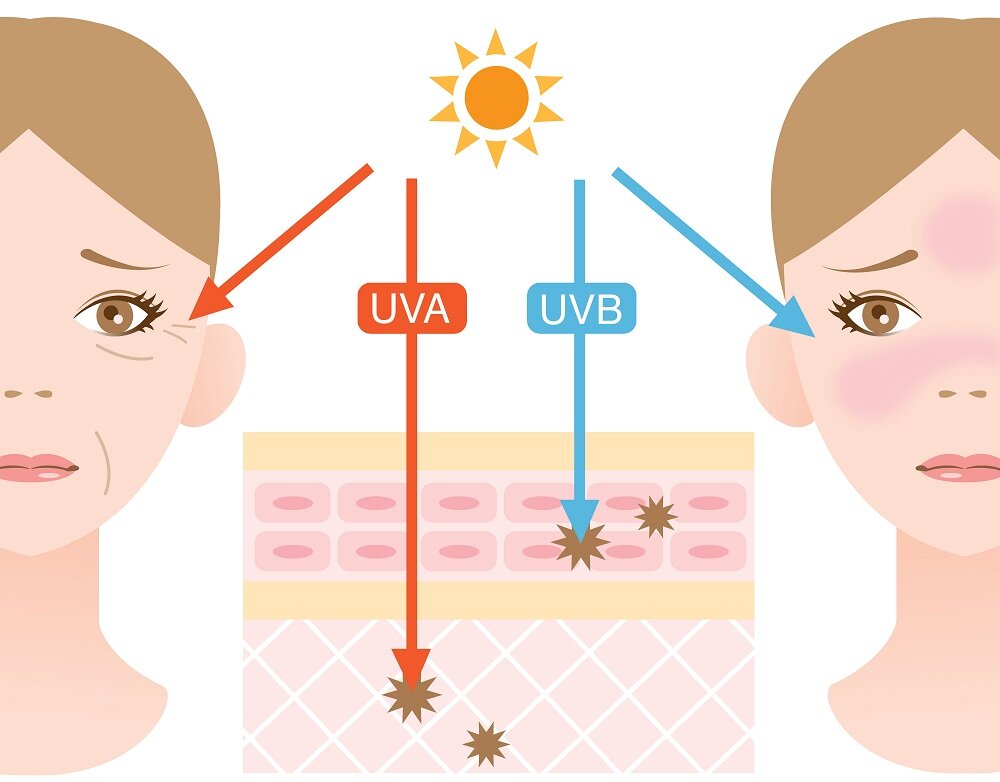 Негативное воздействие на кожу оказывают 2 вида УФ-излучения - UVA и UVB.