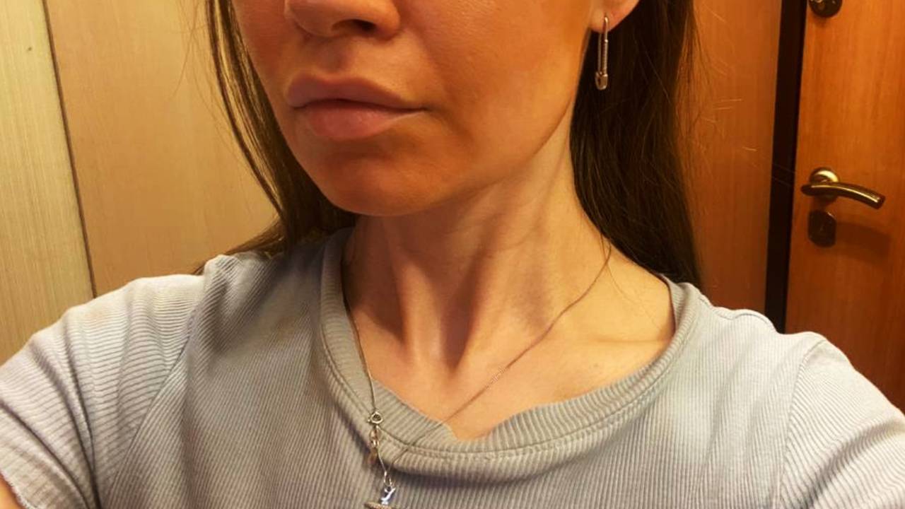 О чём я только думала? Купила водостойкий тональный крем для отпуска по совету консультанта, теперь у меня всё лицо в пятнах4