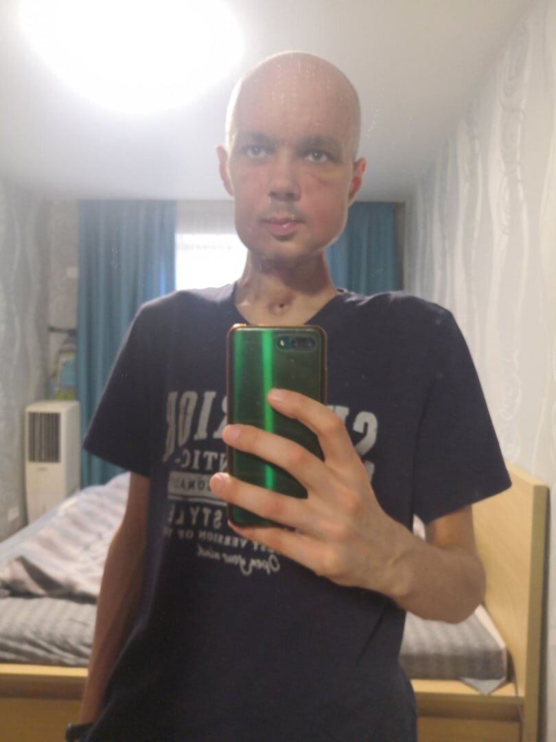 -2